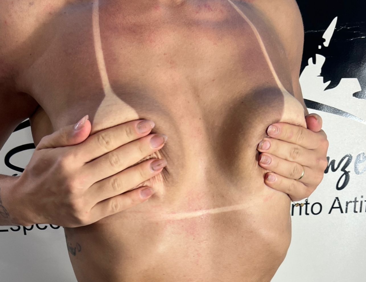 Resultado do bronzeamento - marquinha perfeita